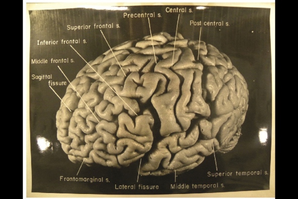 Einstein left lateral small