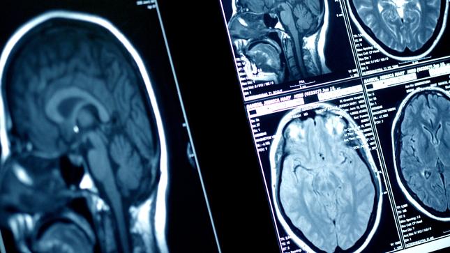 brainswomen