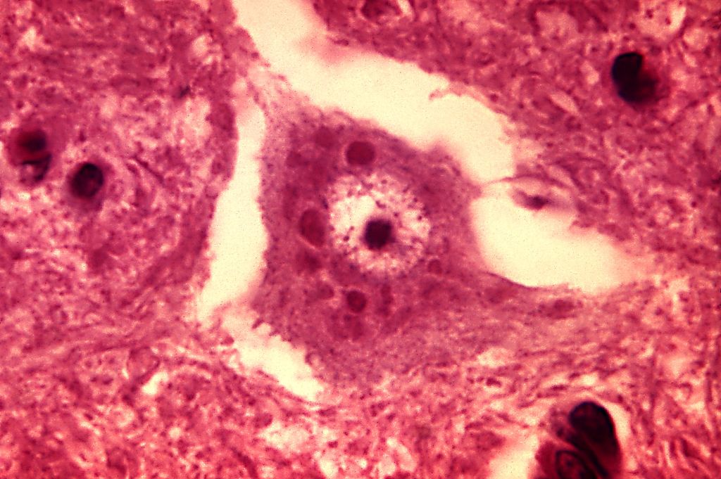 Rabies_encephalitis_Negri_bodies_PHIL_3377_lores